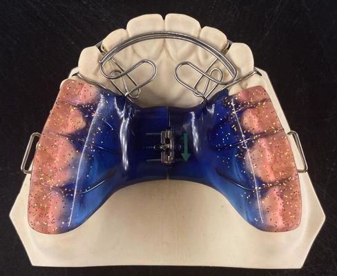 উচ্চ নির্ভুলতা Orthodontic অপসারণযোগ্য যন্ত্রপাতি নিরাপত্তা পরিষ্কার Hawley Retainer